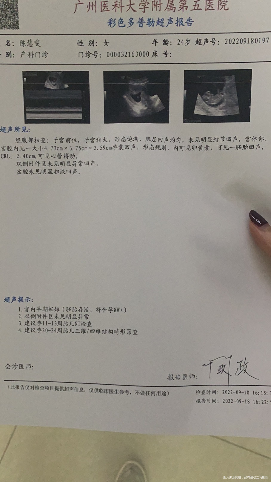 怀孕前有多囊这胎是自然怀孕3号孕7周18号差