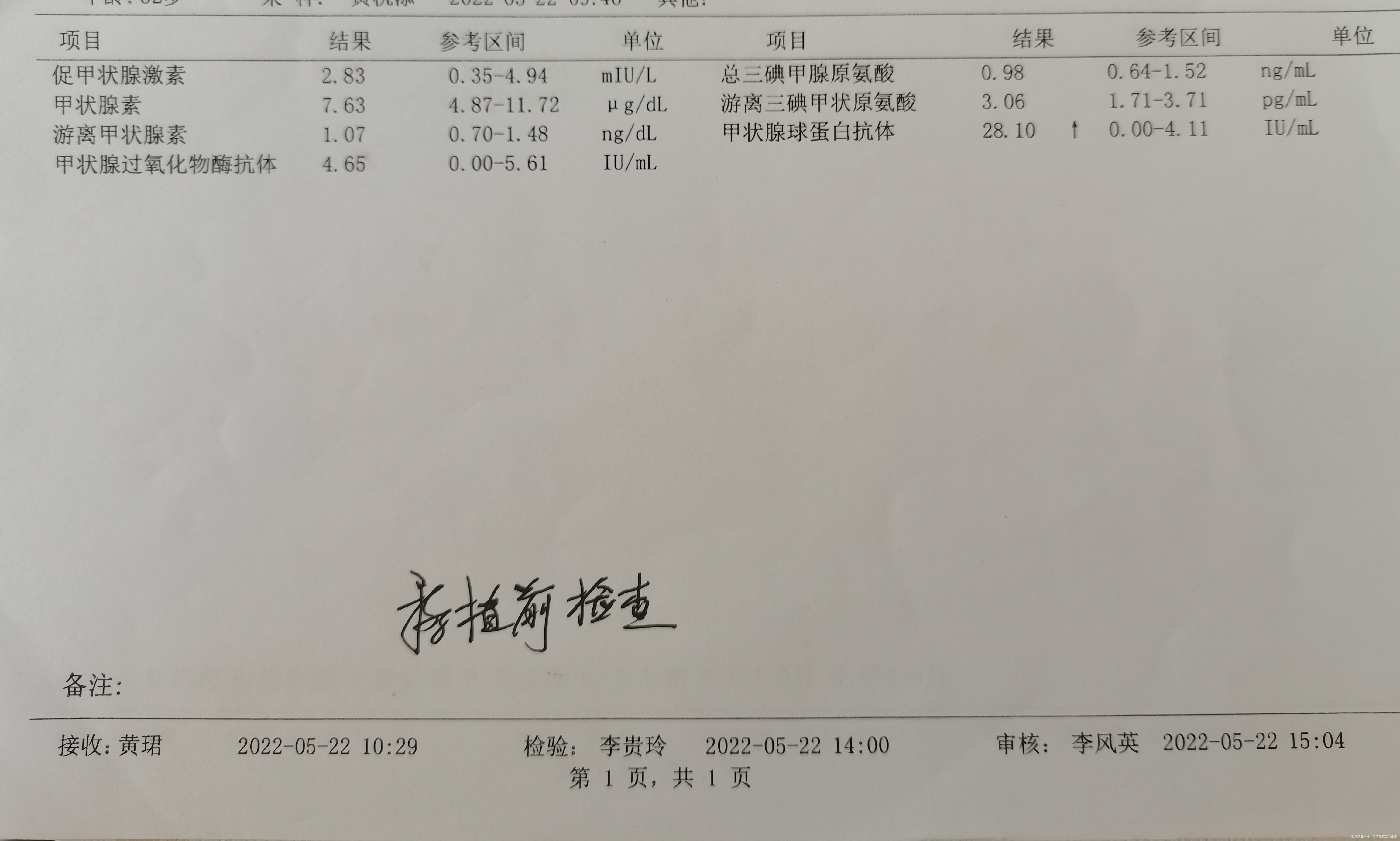 今天是移植第43天复查甲状腺功能促甲状腺素怎