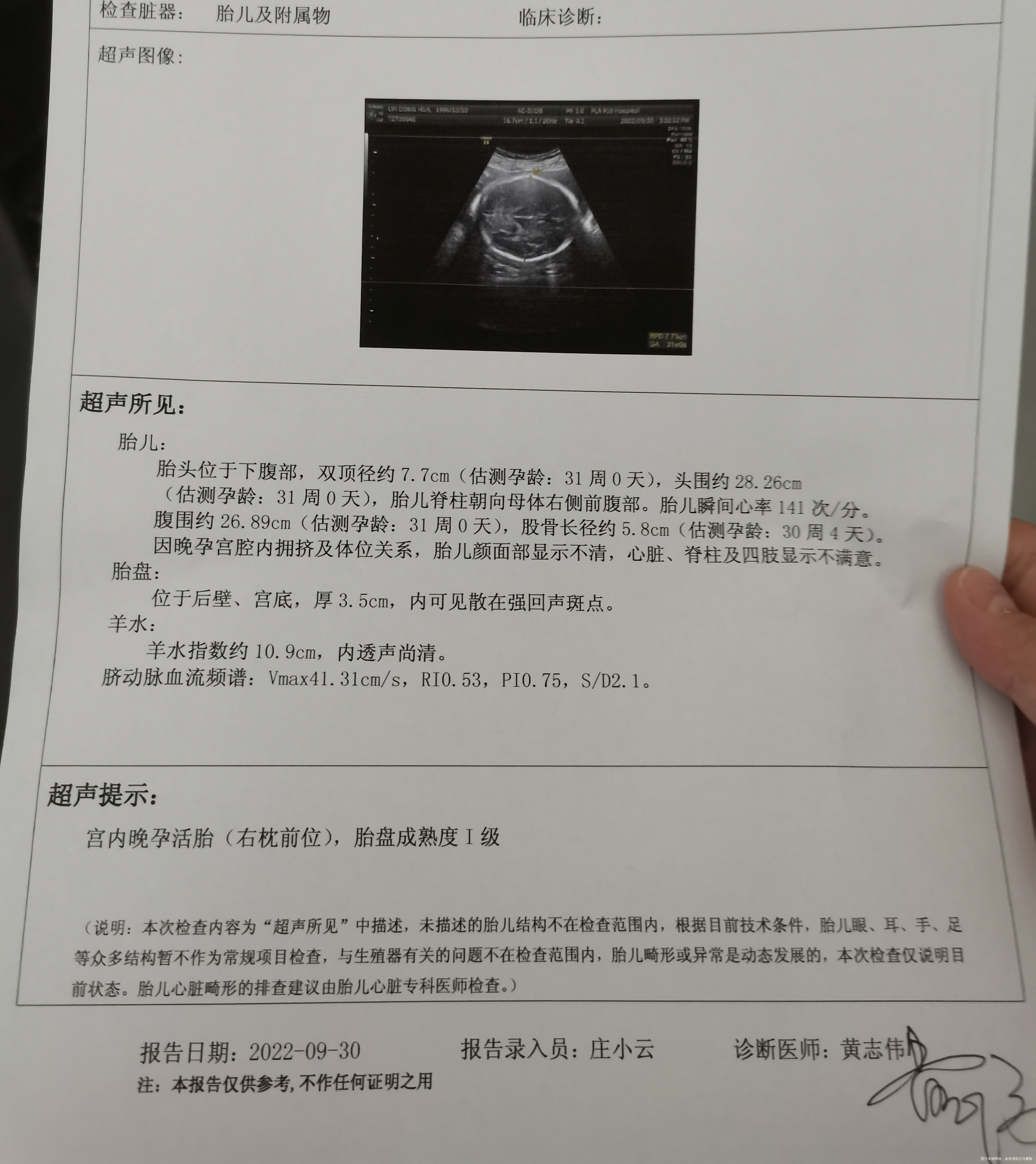 今天31+5帮我看下彩超有没有问题我看好像偏