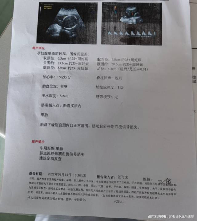 血压高吃拉贝控制在14090彩超这样大夫说孩