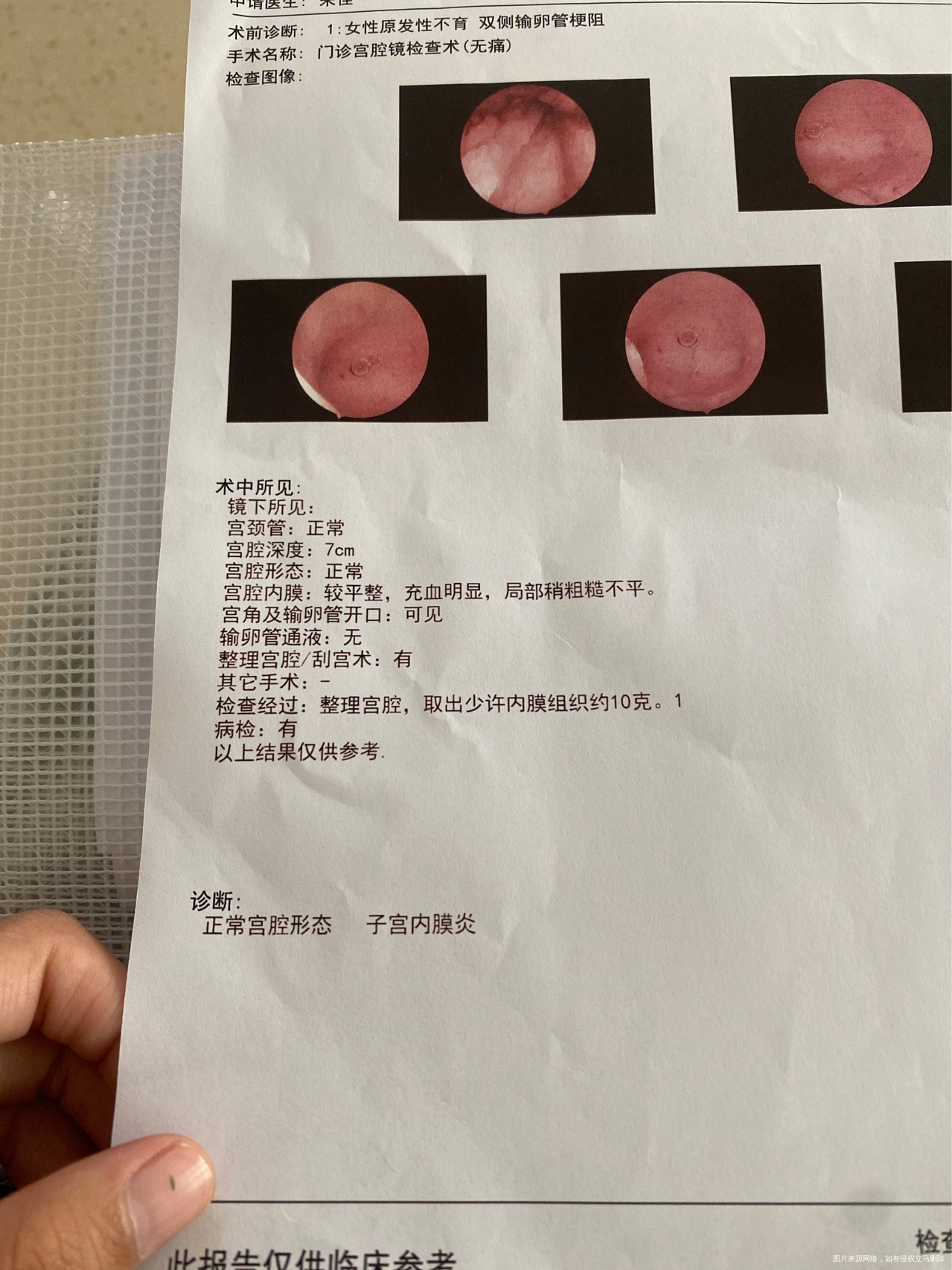 刚做完这个情况严重吗