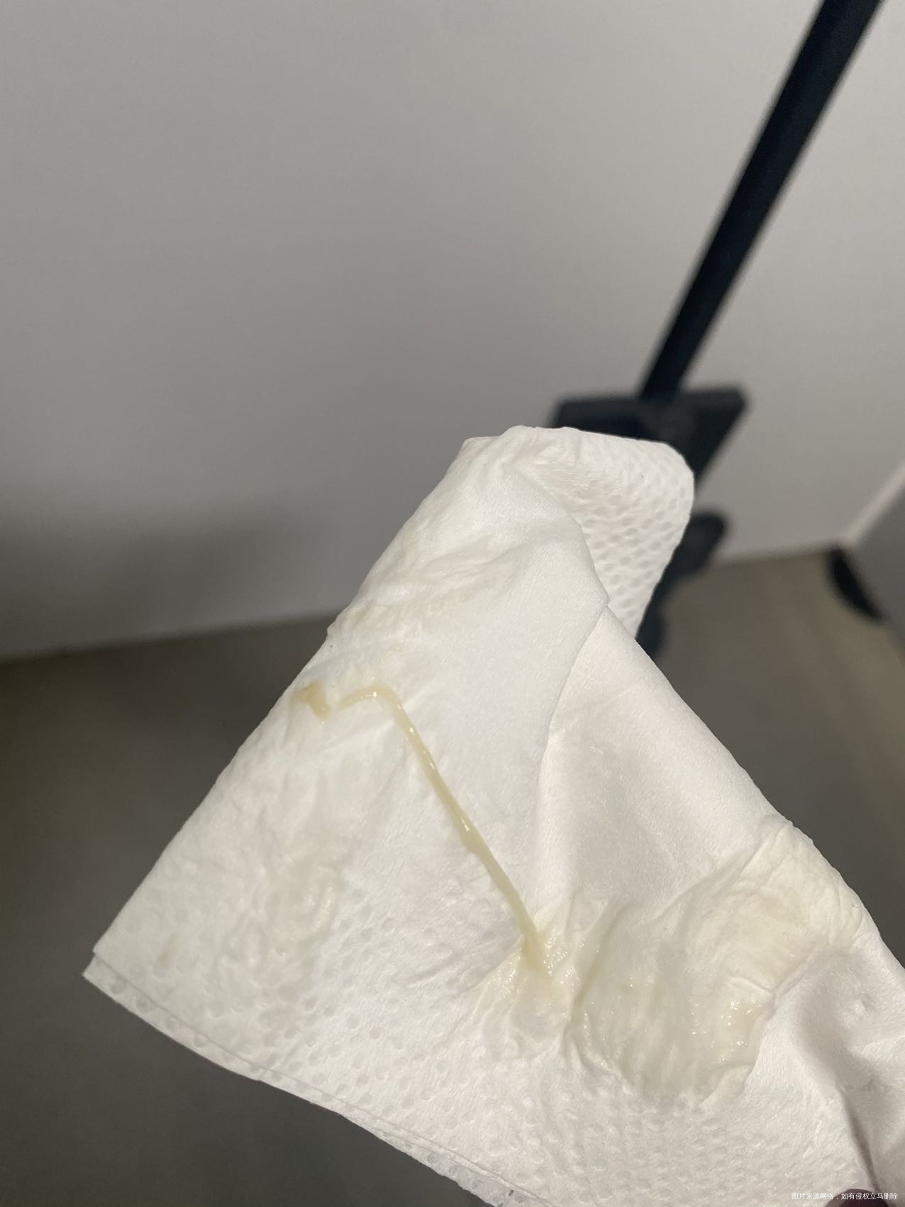 怀孕前有多囊这胎是自然怀孕3号孕7周18号差