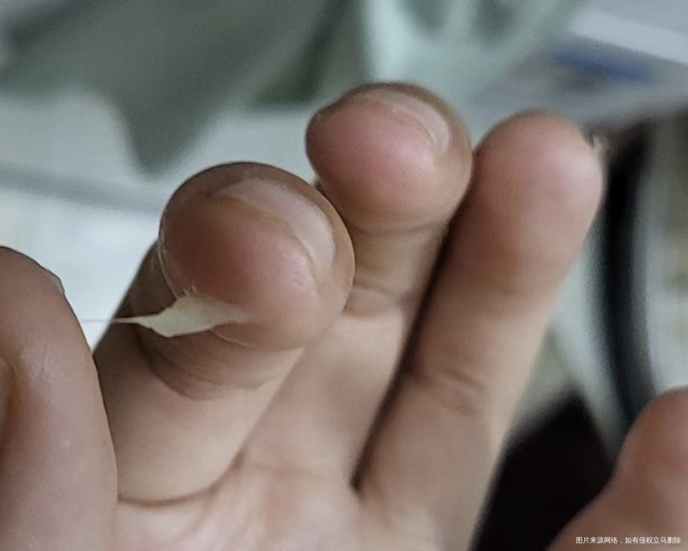 明天显示来大姨妈今天白带像果冻一样正常吗