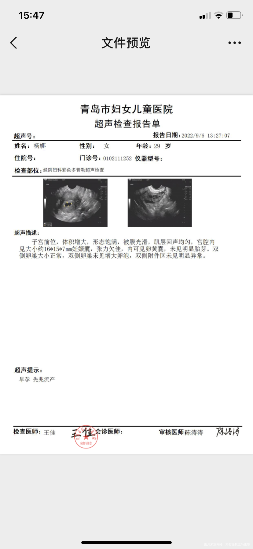 现在是孕6周了一直用黄体酮凝胶和达芙通5周的