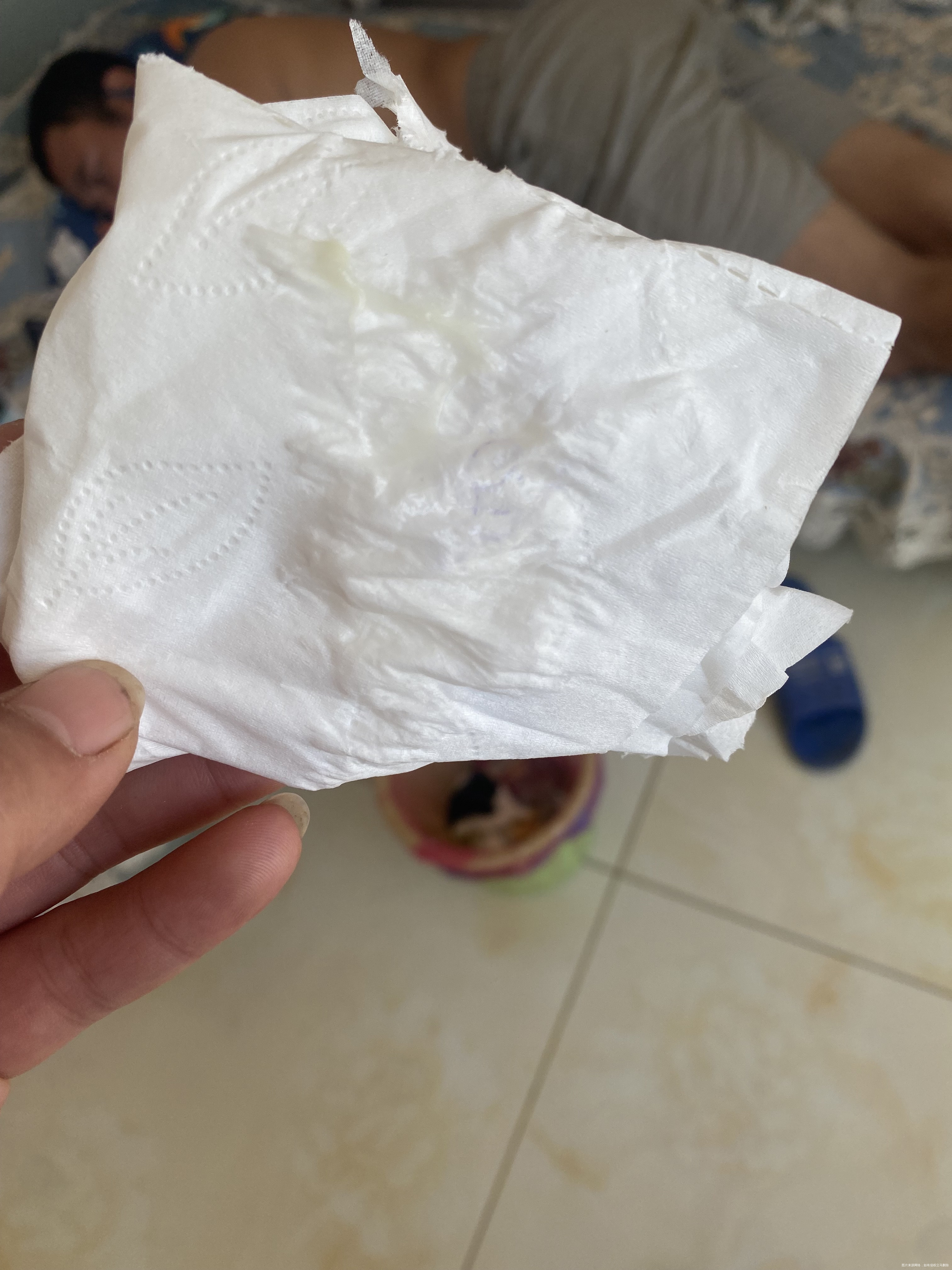 做完宫腔镜有拉丝有点颜色白带正常吗以前没有这