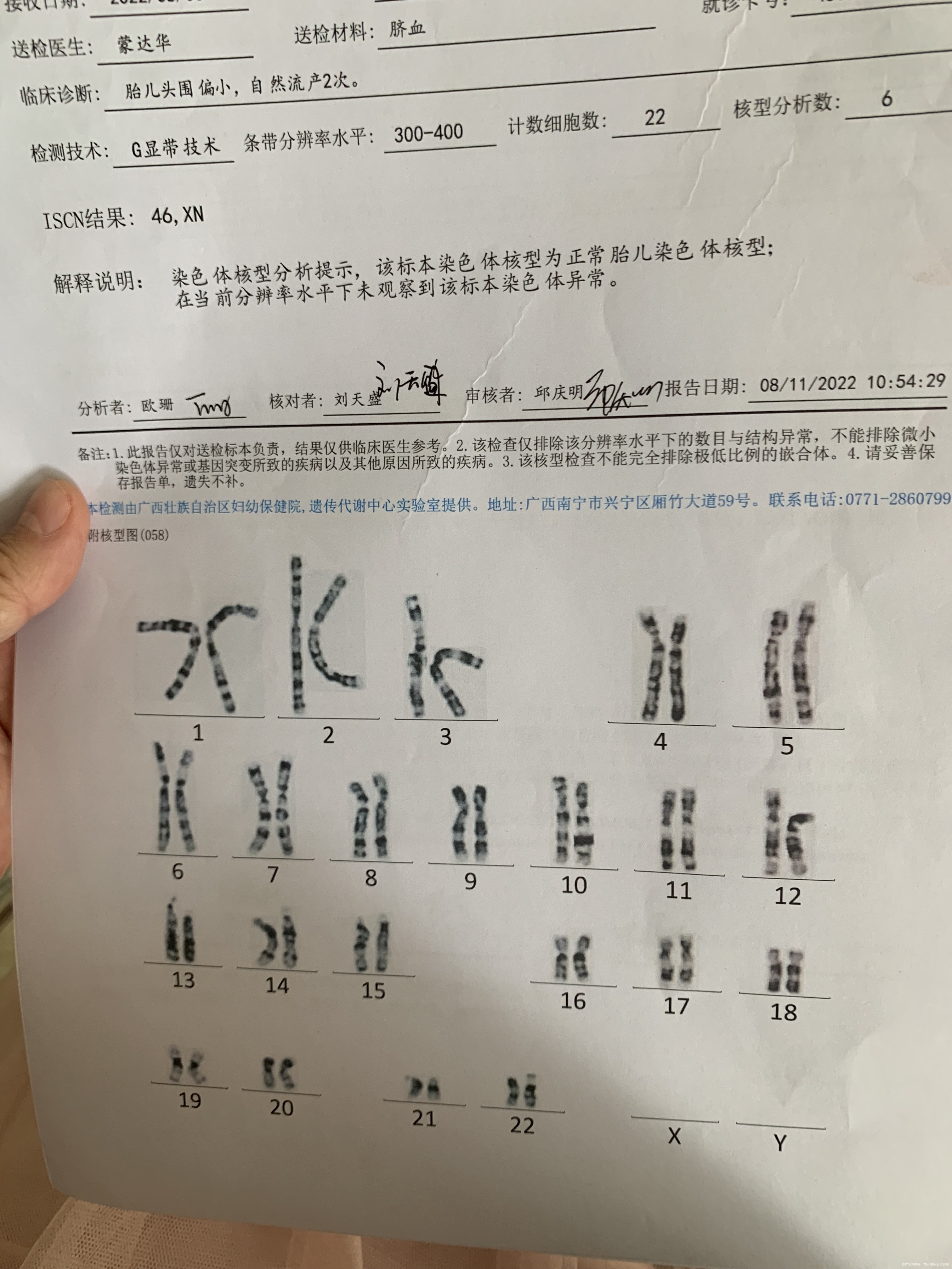 孕38周+4明天剖腹产刚才医生说有一个耳聋基