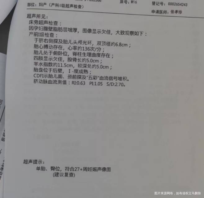 臀位必须得剖宫产吗很担心疼