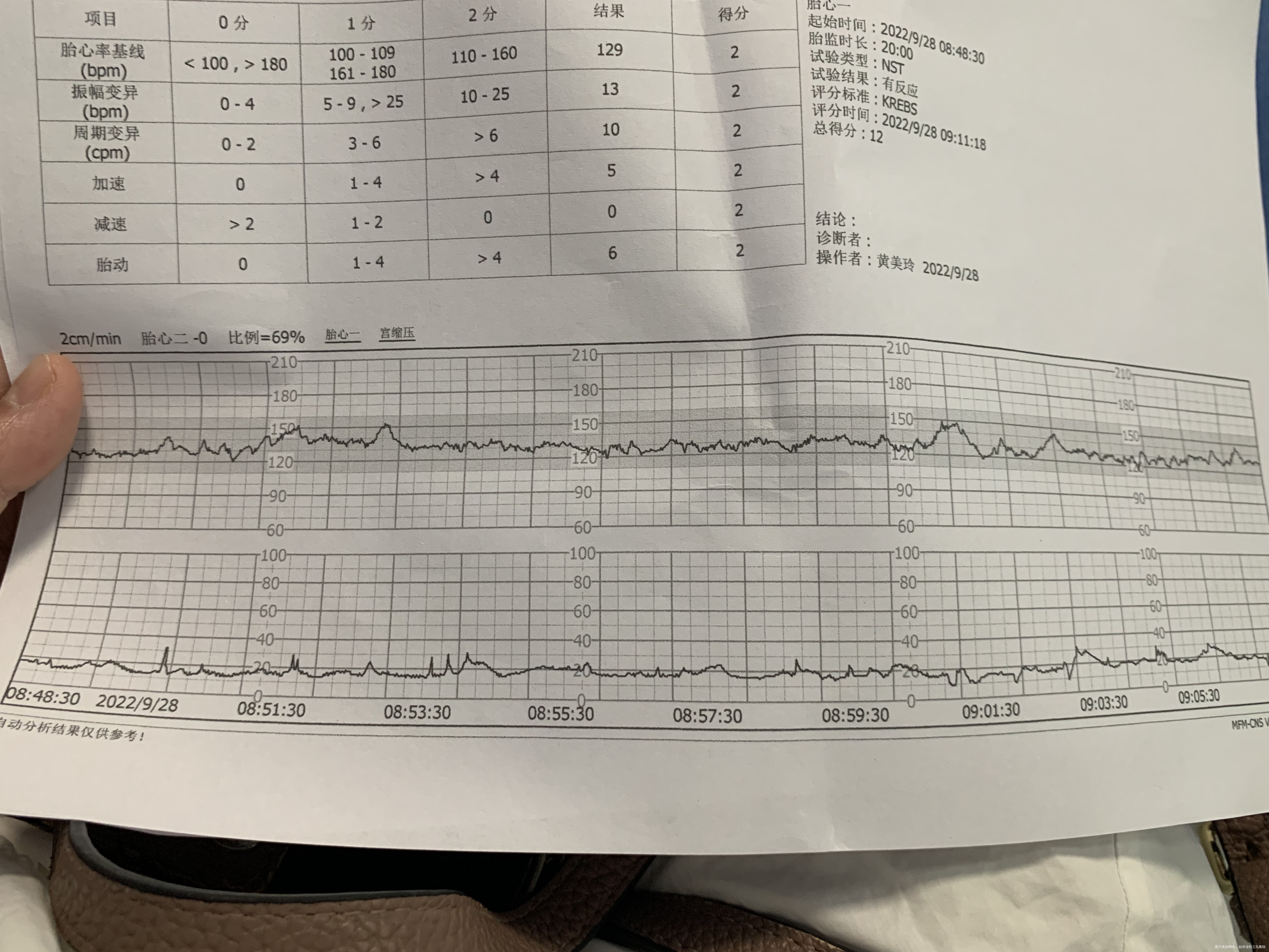 今天38+2了本来打算30号入院10月1号剖