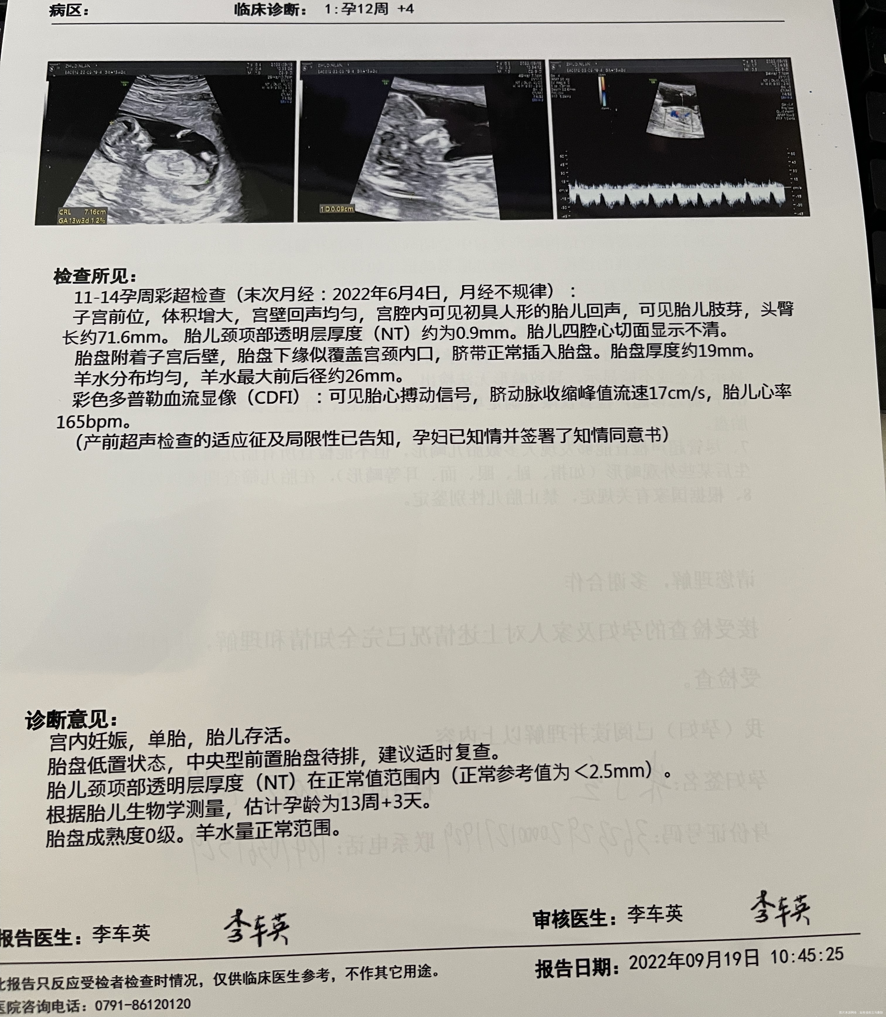 这是今天做的NT想知道胎儿发育的怎样靠近宫颈