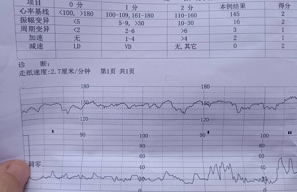 能不能帮我看看这次胎监有没有异常38周了显示