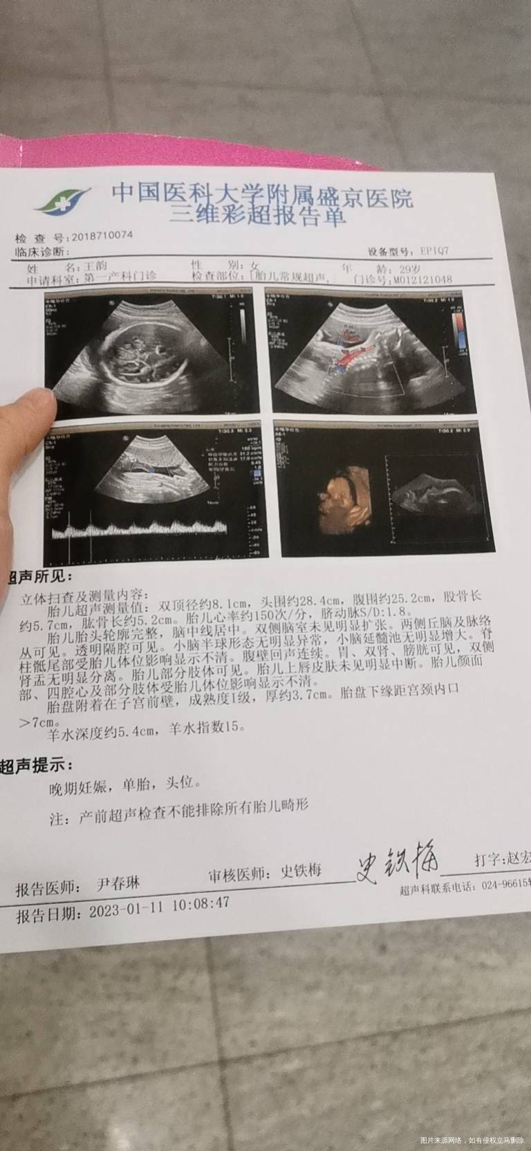 麻烦看下我的小排畸有问题吗30+3孩子发育怎