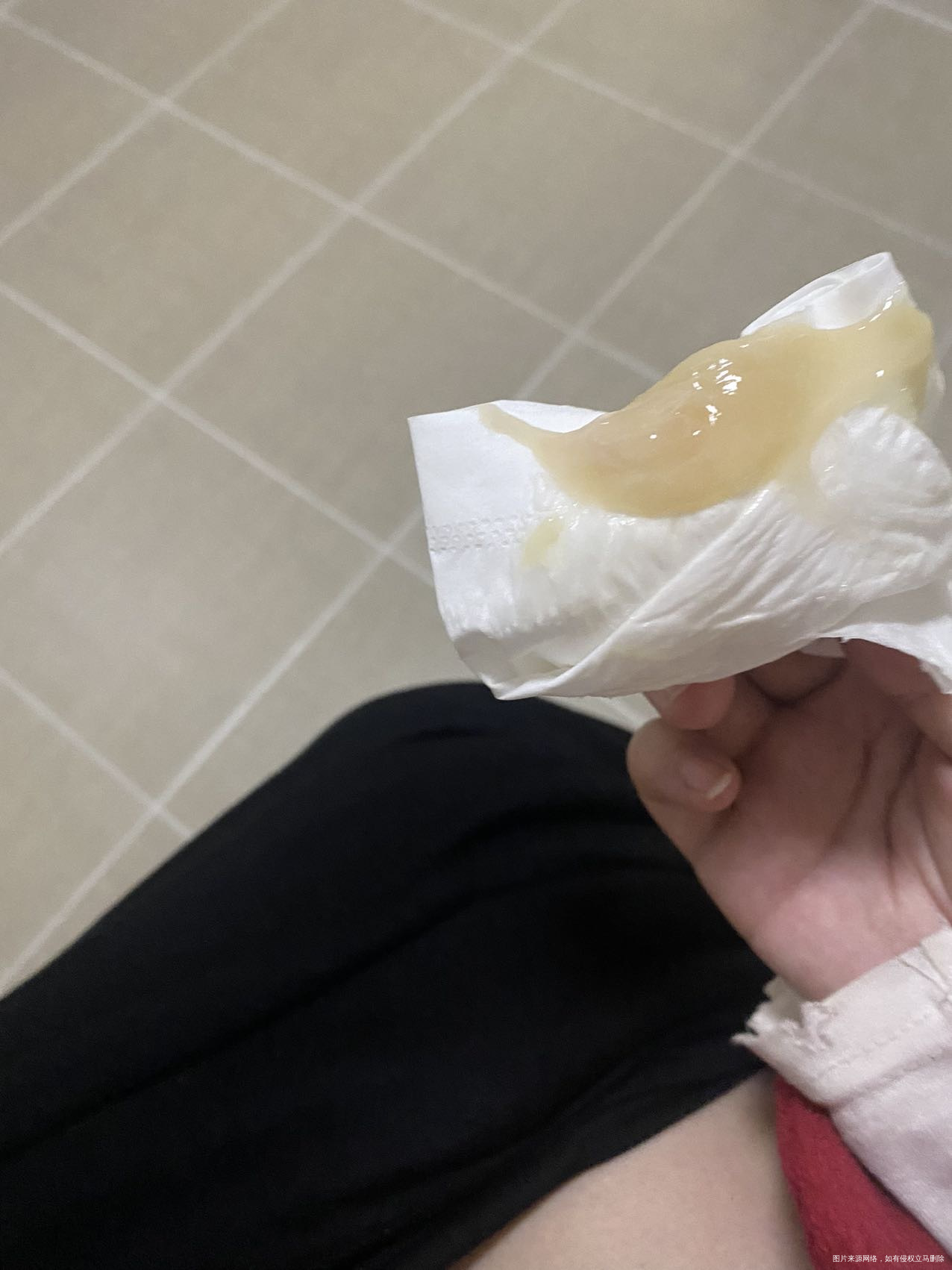 目前孕40+3昨天开始流一些宫腔粘液刚才突然