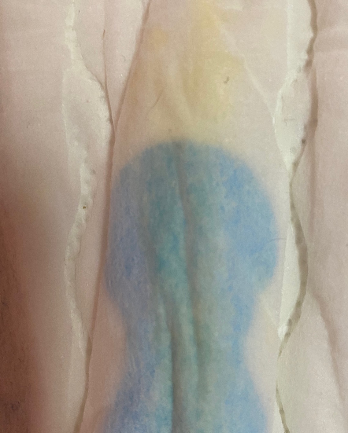 孕15周多这二天流乳白色分泌物干了就有点发黄