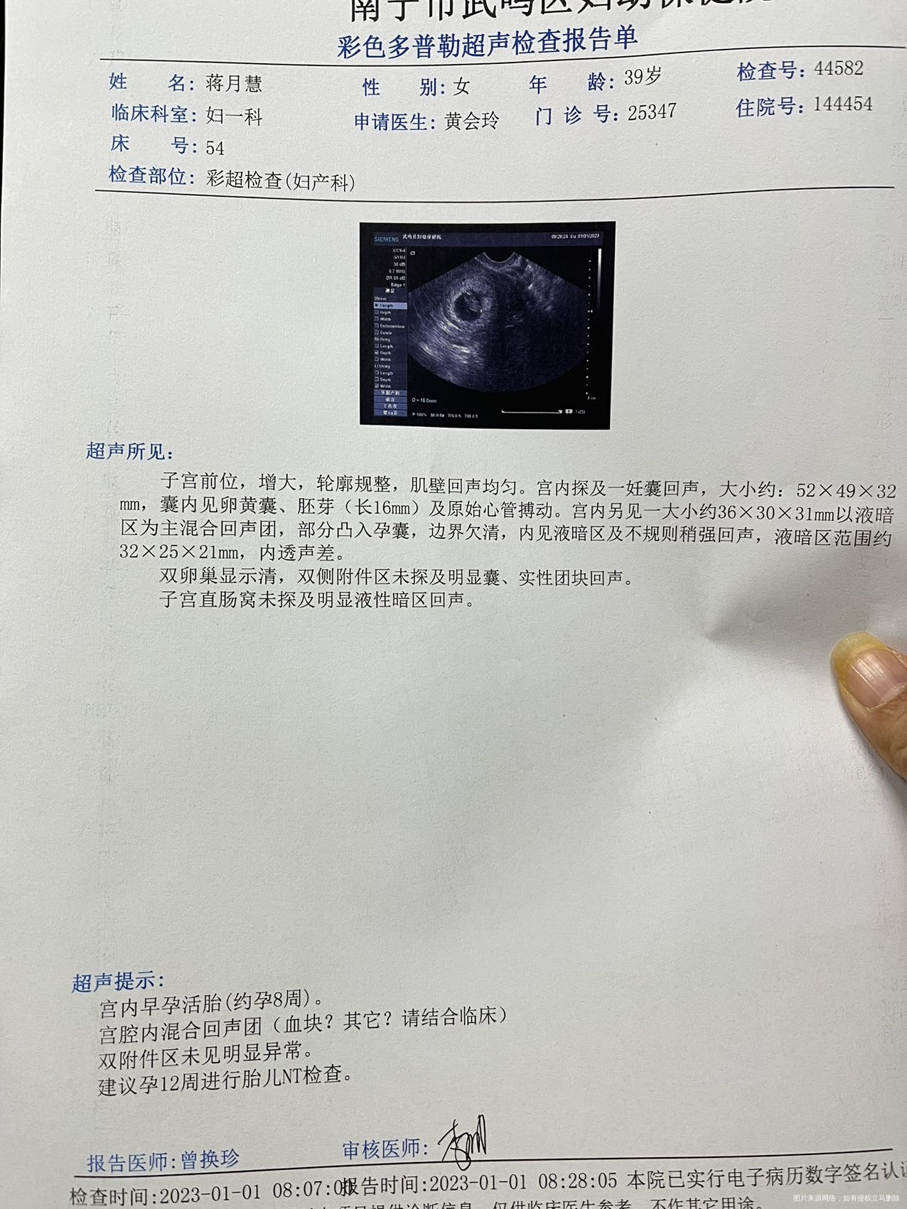 这个血块蛮大的能慢慢消掉吗