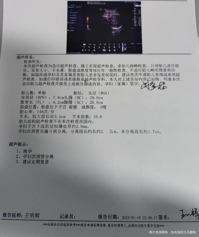 老婆做的彩超已经住院了孩子需要进保温箱吗花多