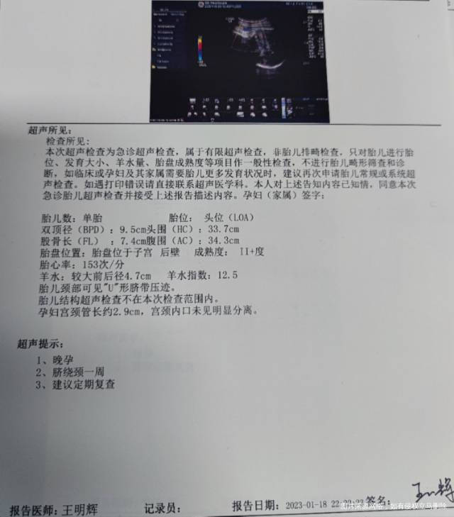 大夫忙也没说啥39➕2肚子有时候紧之前没有绕