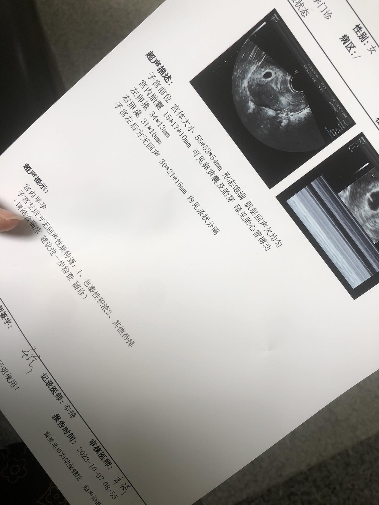 移植第二十四天做的超声肌层回声欠均匀有什么问