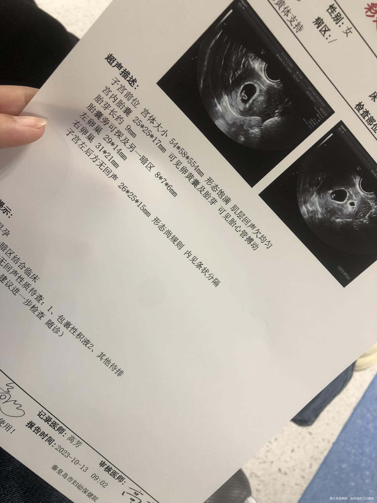 这是我今天检查结果胎囊旁边又出现了一个不知是