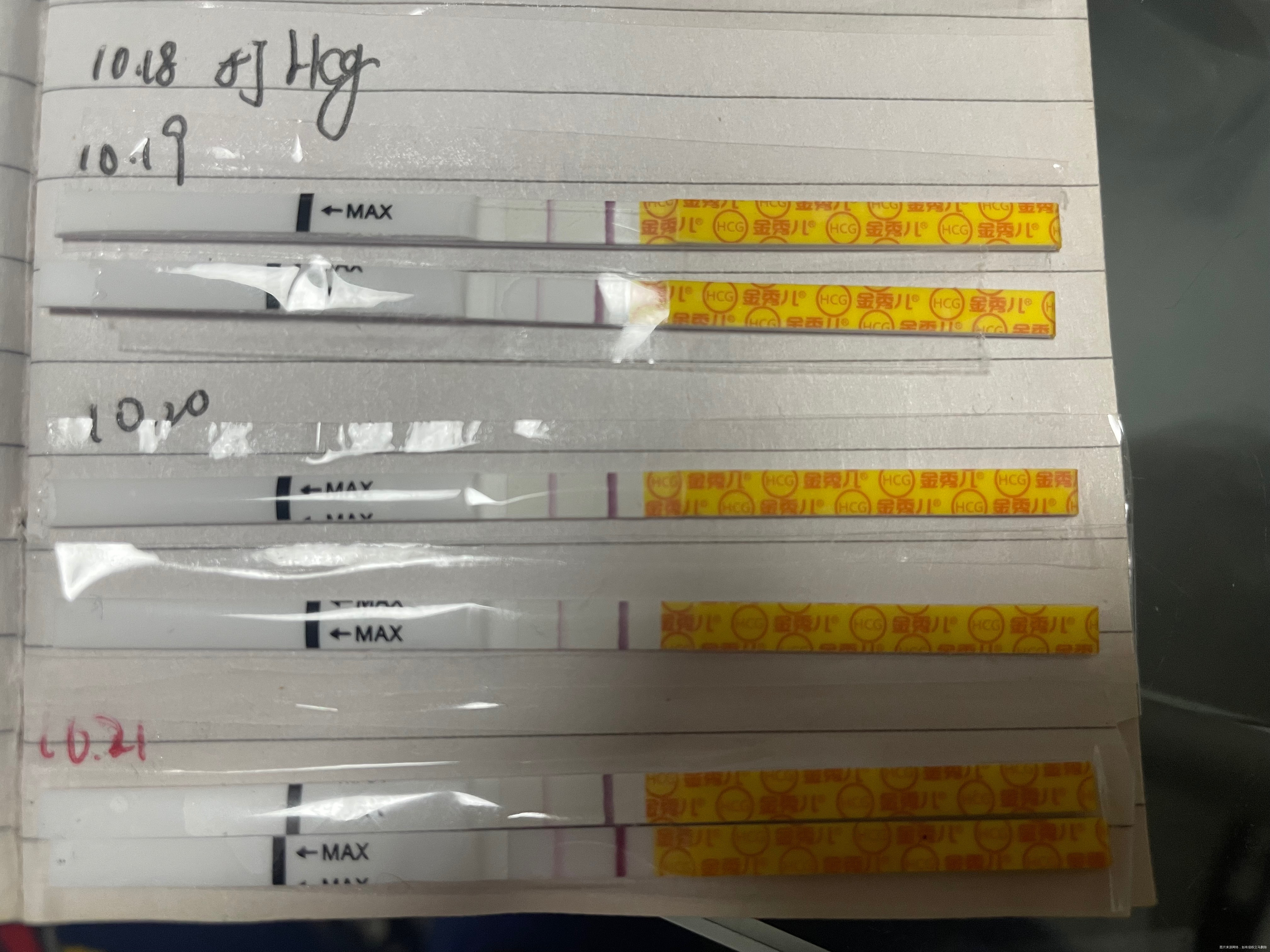 1012号移植两个Day3的冻胚~1018号