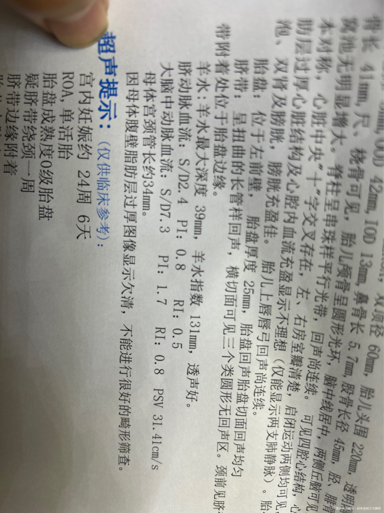 做了四维帮忙看一下羊水和大脑脉血流正常吗