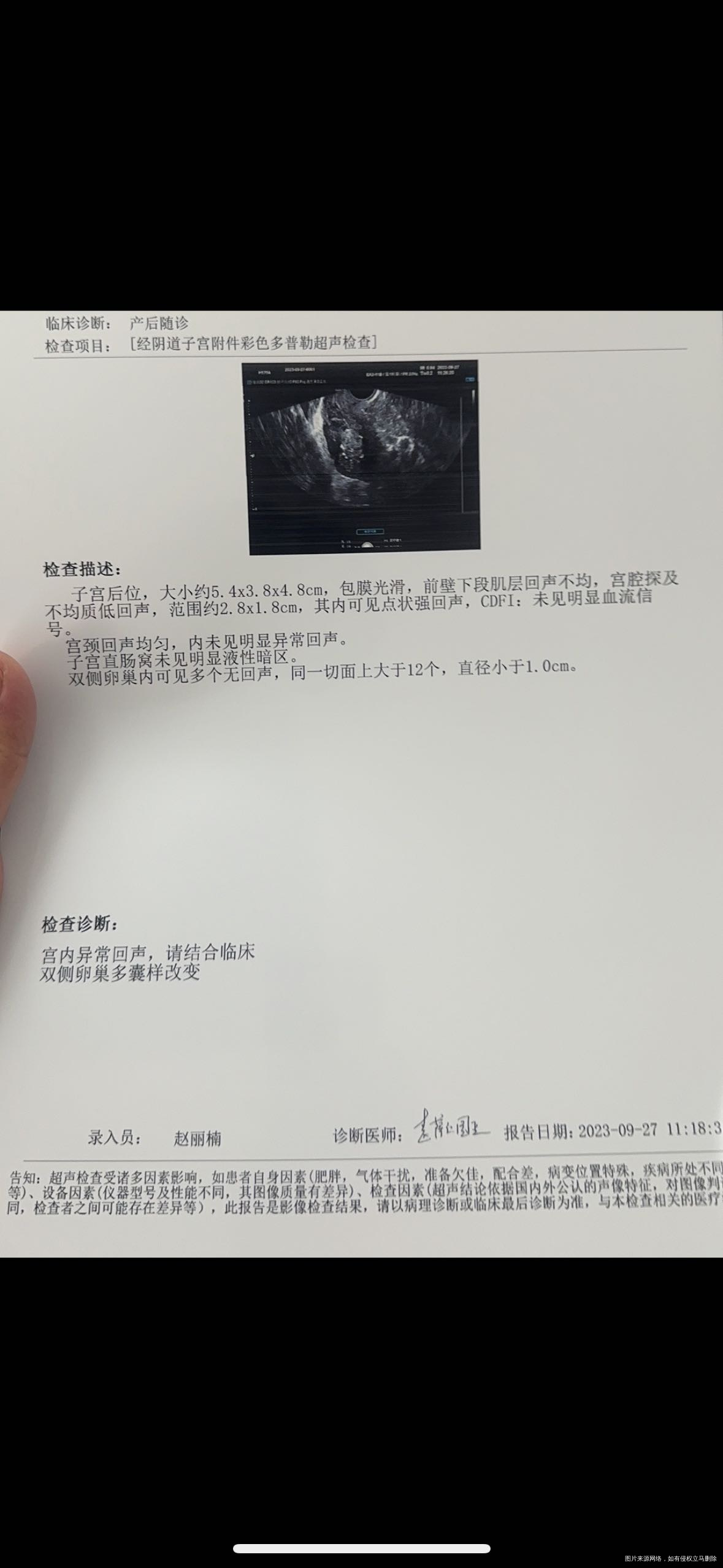 剖腹产44天了一直有血产后检查单在下面吃了益