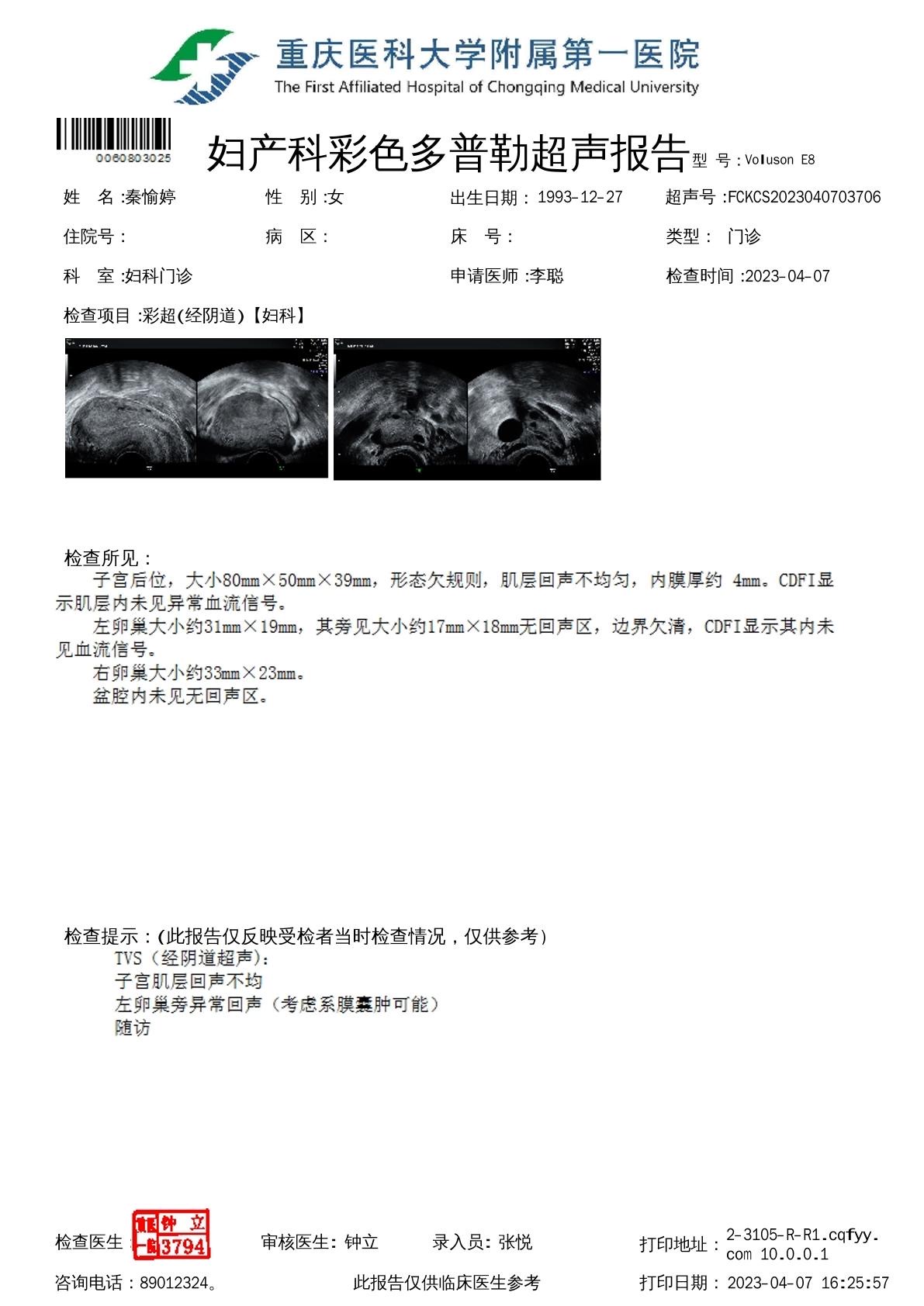 我想知道我有没有多囊卵巢综合症备孕半年左右还