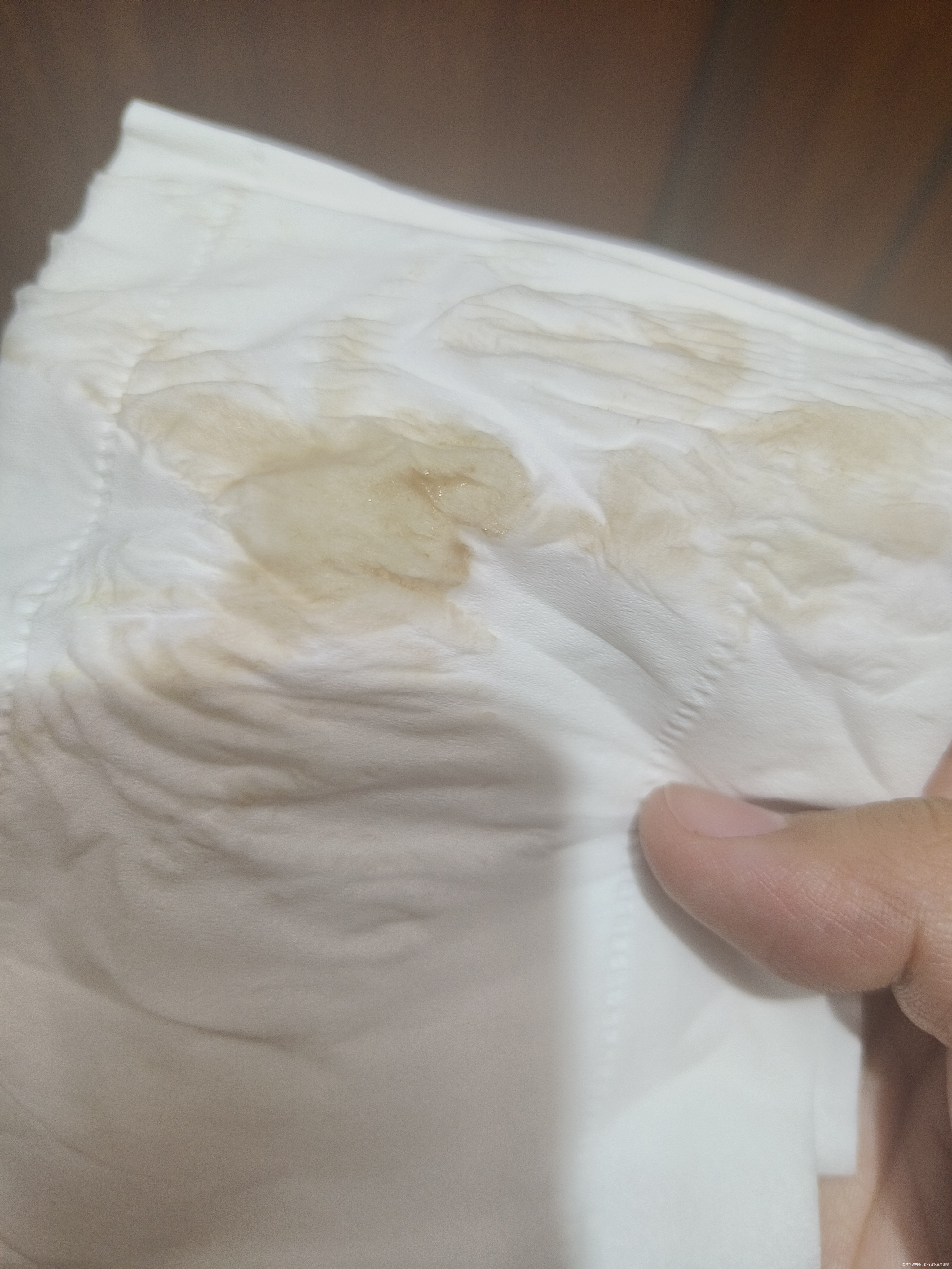 我这刚怀孕4周1天就有咖啡色分泌物怎么回事啊