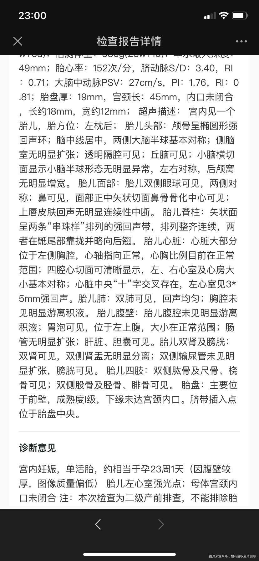 四维检查说母体宫颈口未闭合接诊医生说不要颠簸
