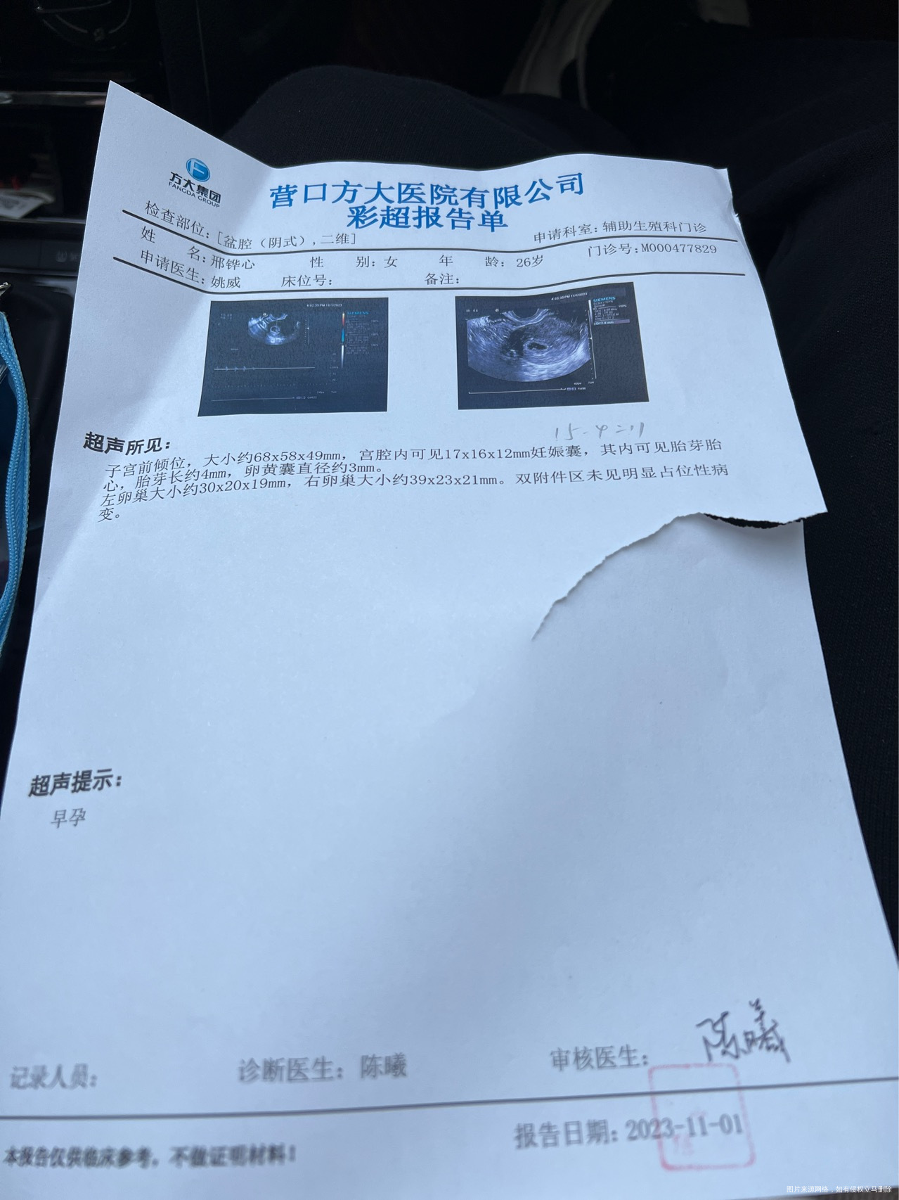 这个孕囊大小有啥问题吗