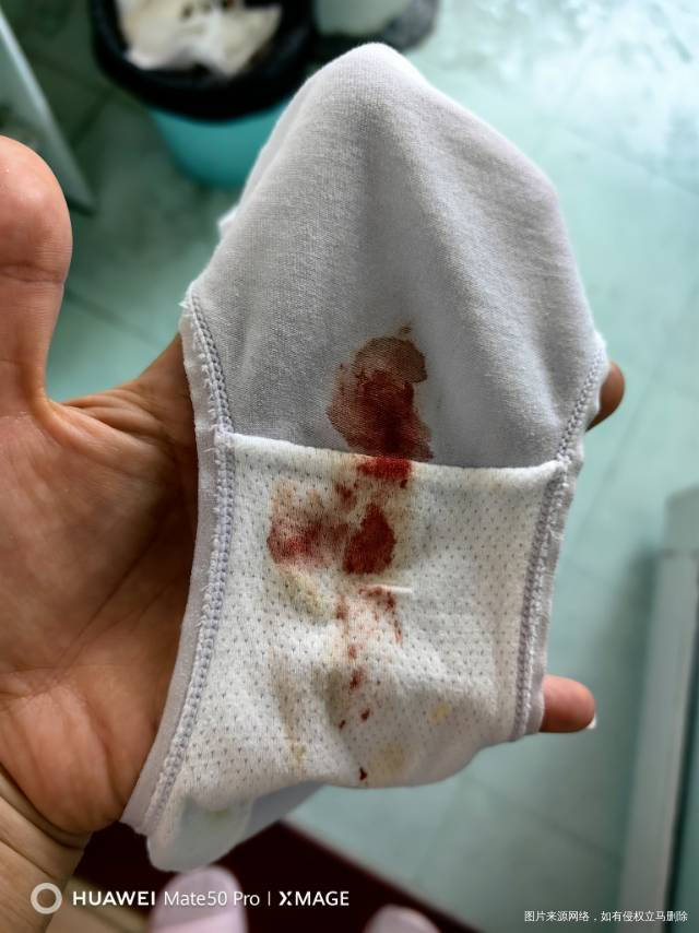 10月26号移植的囊胚今天上午做了个阴超回来