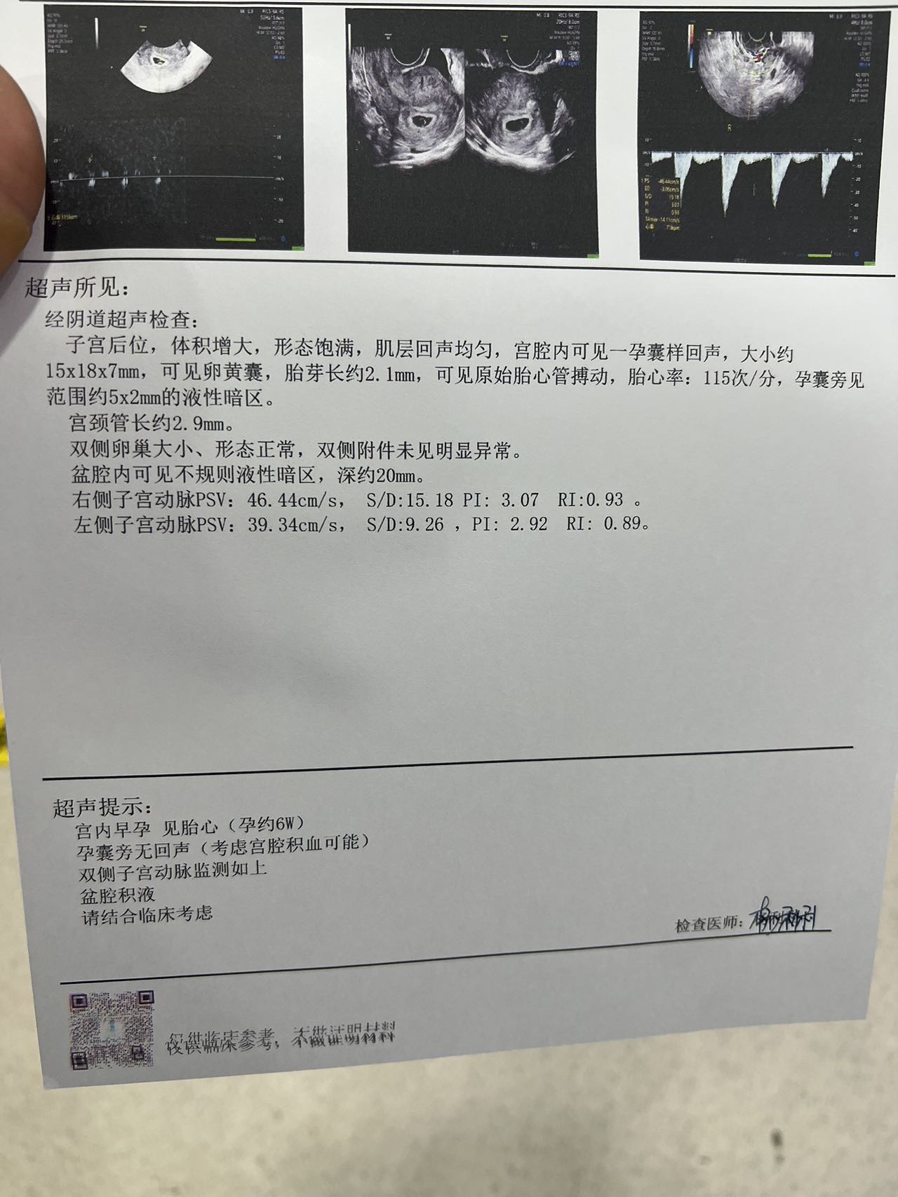 我失眠的情况怎么样改善呢我白天也不困晚上就睡