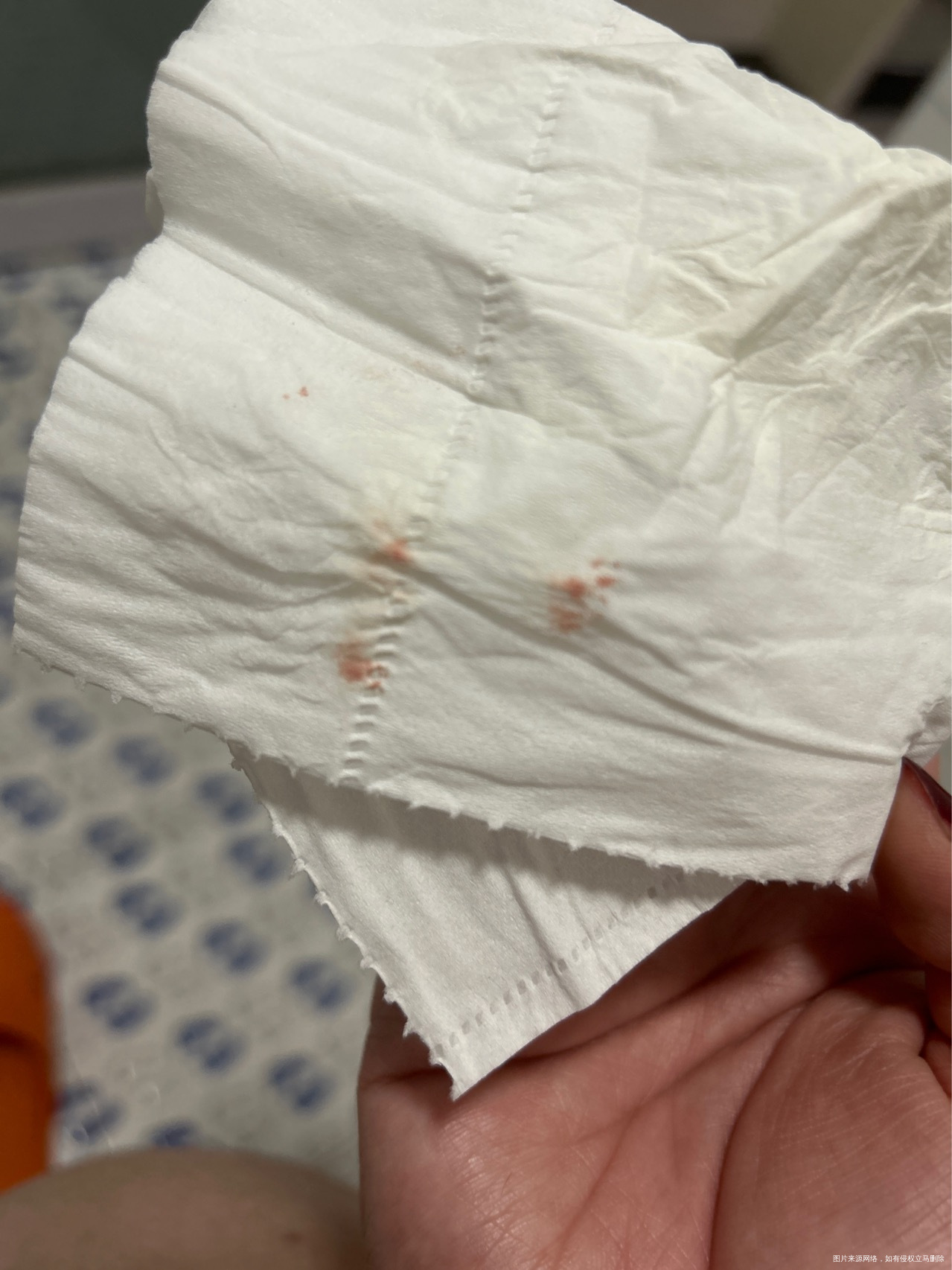 孕32周上小便擦出来血像渗血那种不多然后紧接