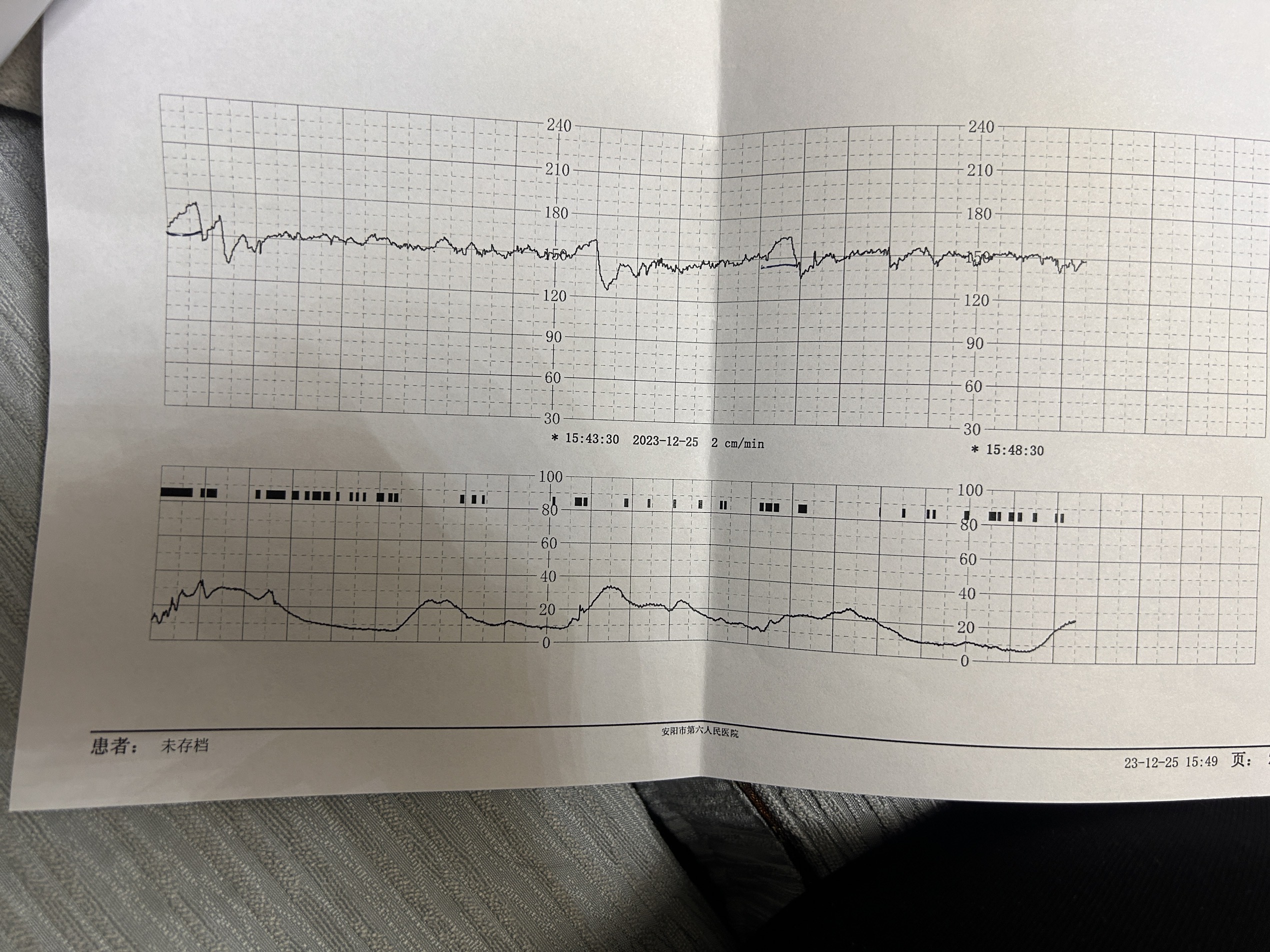医生帮我看看胎心监护结果孕35周