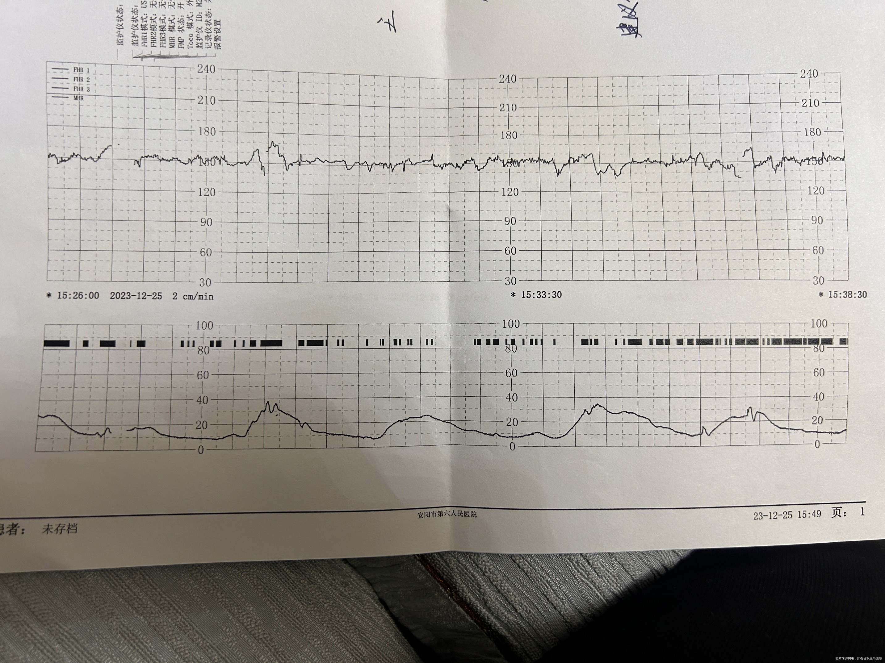 医生帮我看看胎心监护结果孕35周
