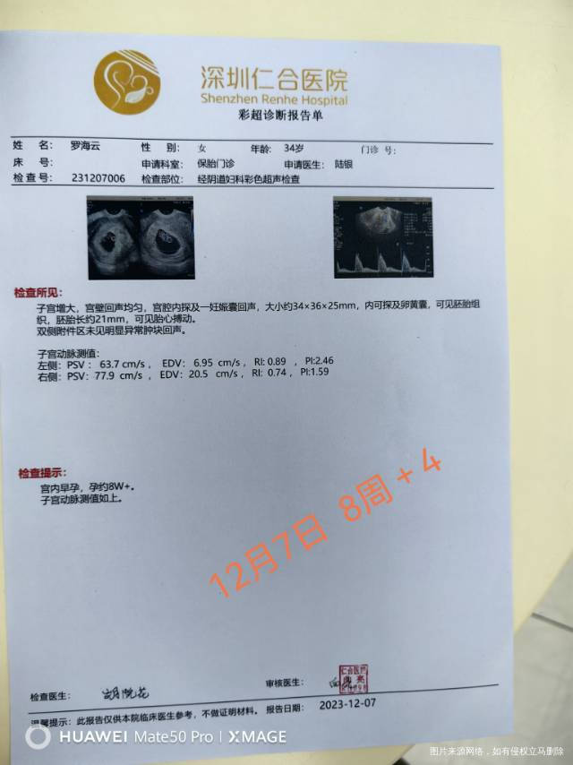 10月26号移植的囊胚今天上午做了个阴超回来