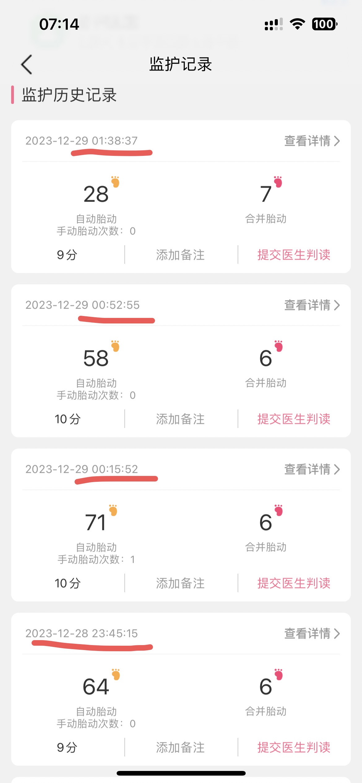 求回复急急急感觉娃动的厉害自己做了胎心监护这