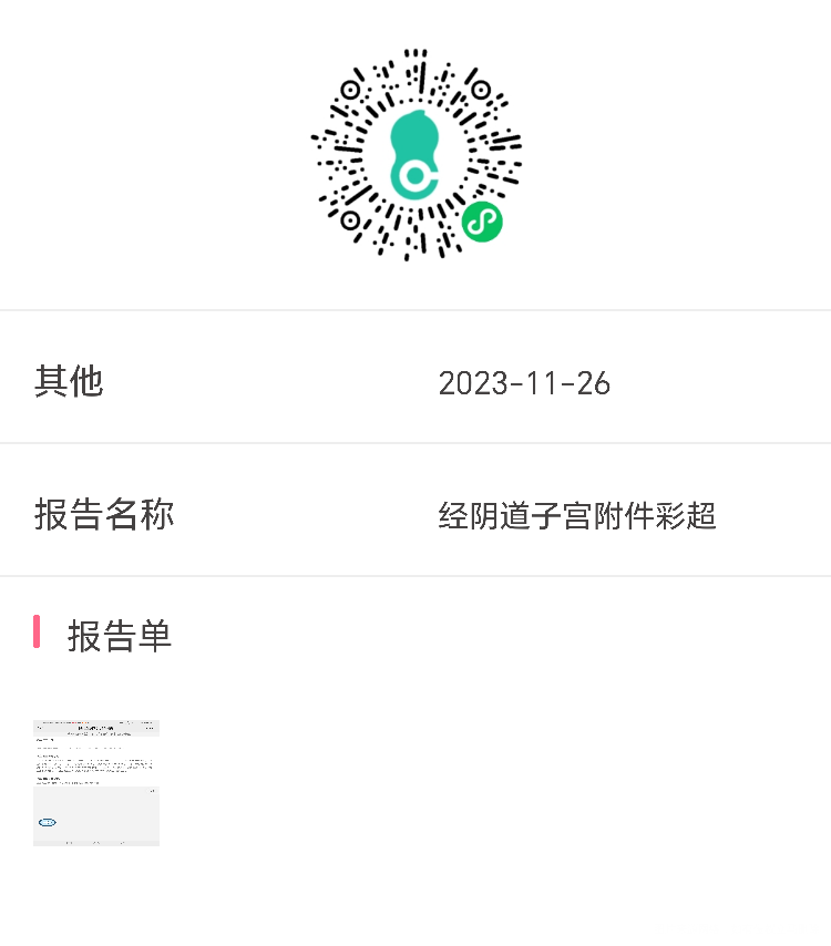 月经第14天这大概什么问题