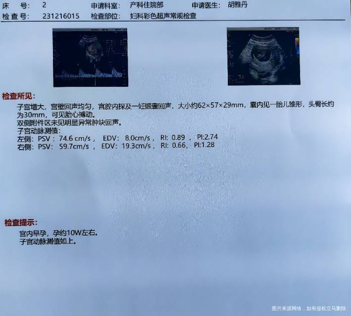 想请问一下医生这个报告显示子宫动脉血流高吗