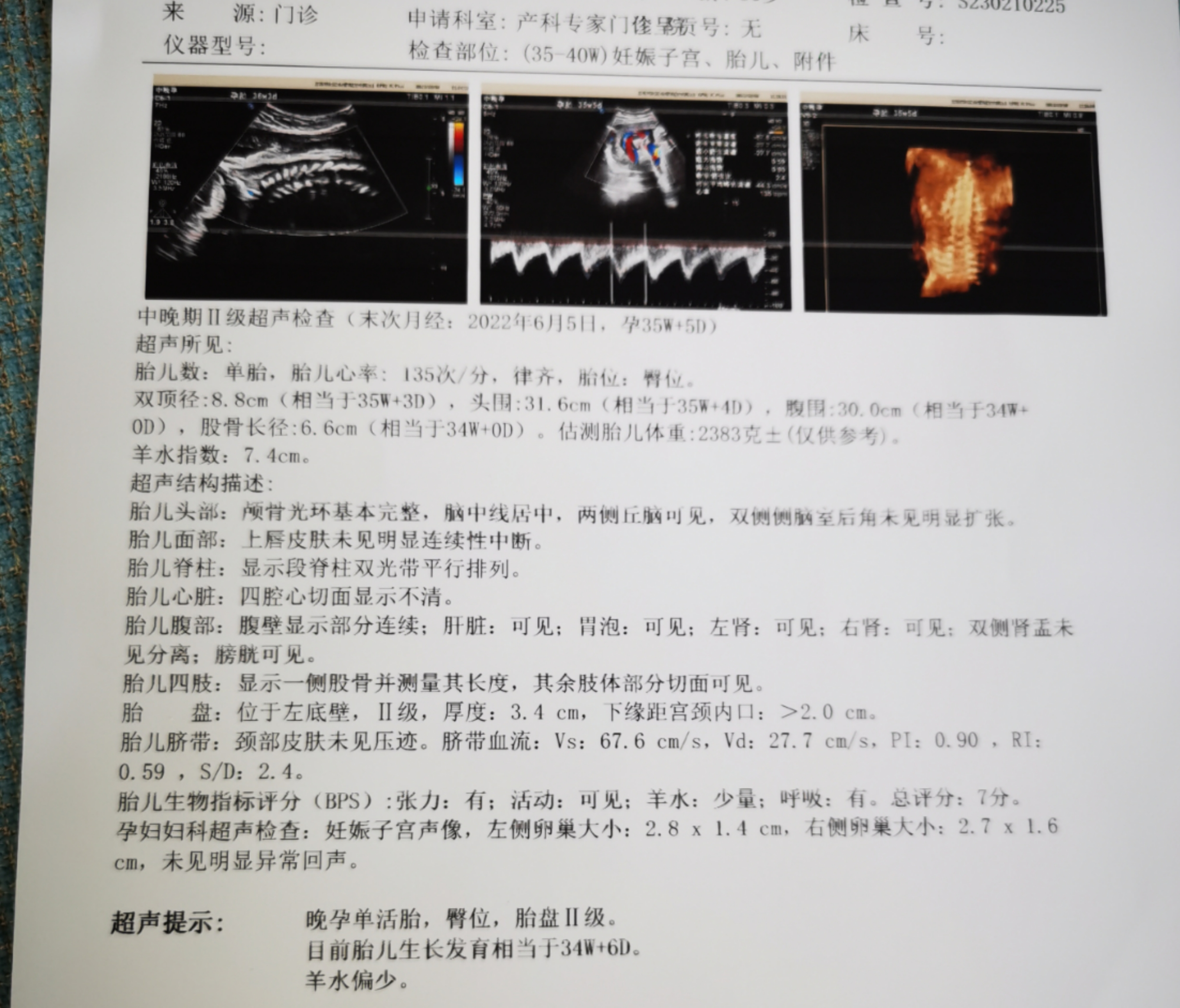 医生您好请问这个b超正常吗羊水少是因为什么呢