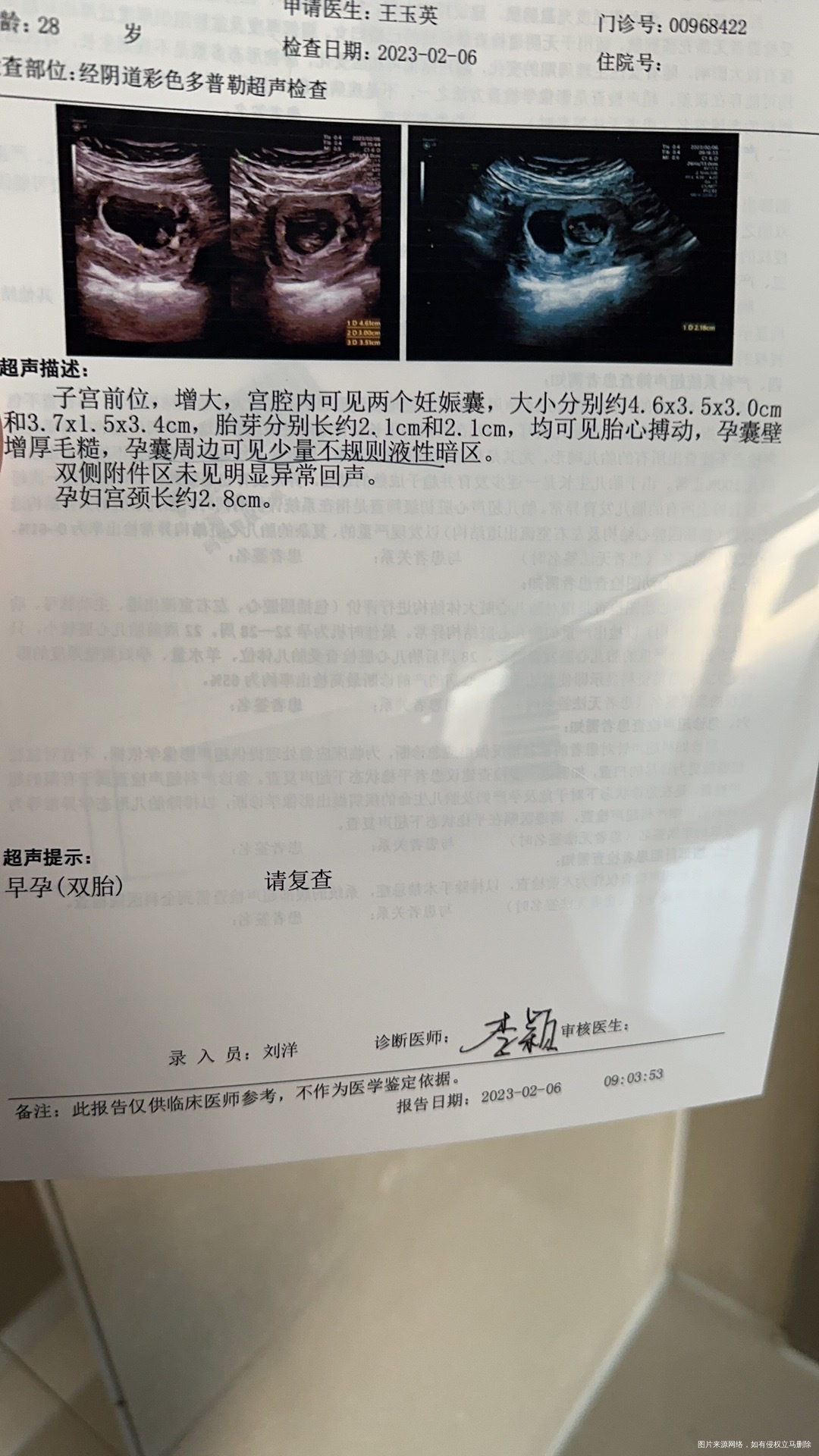 试管8周➕4前10天b超没有液性暗区现在有了