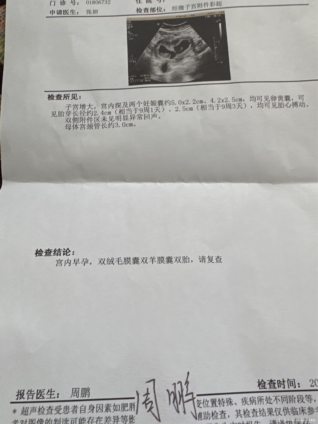 同时移植了两个囊胚现在b超一大一小正常吗