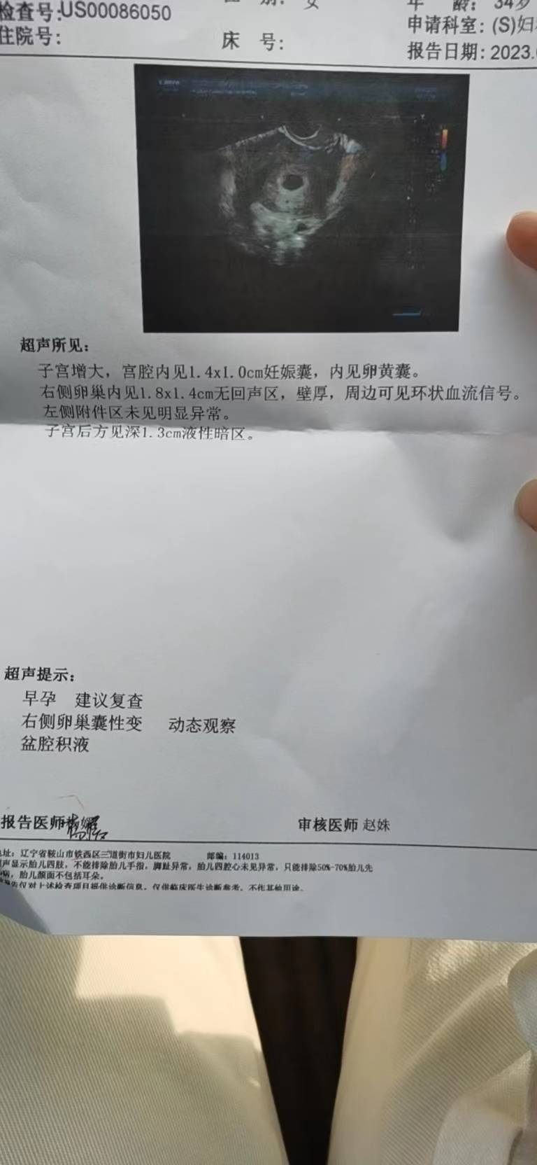 麻烦大夫看看五周多六天的彩超单子还有右侧卵巢