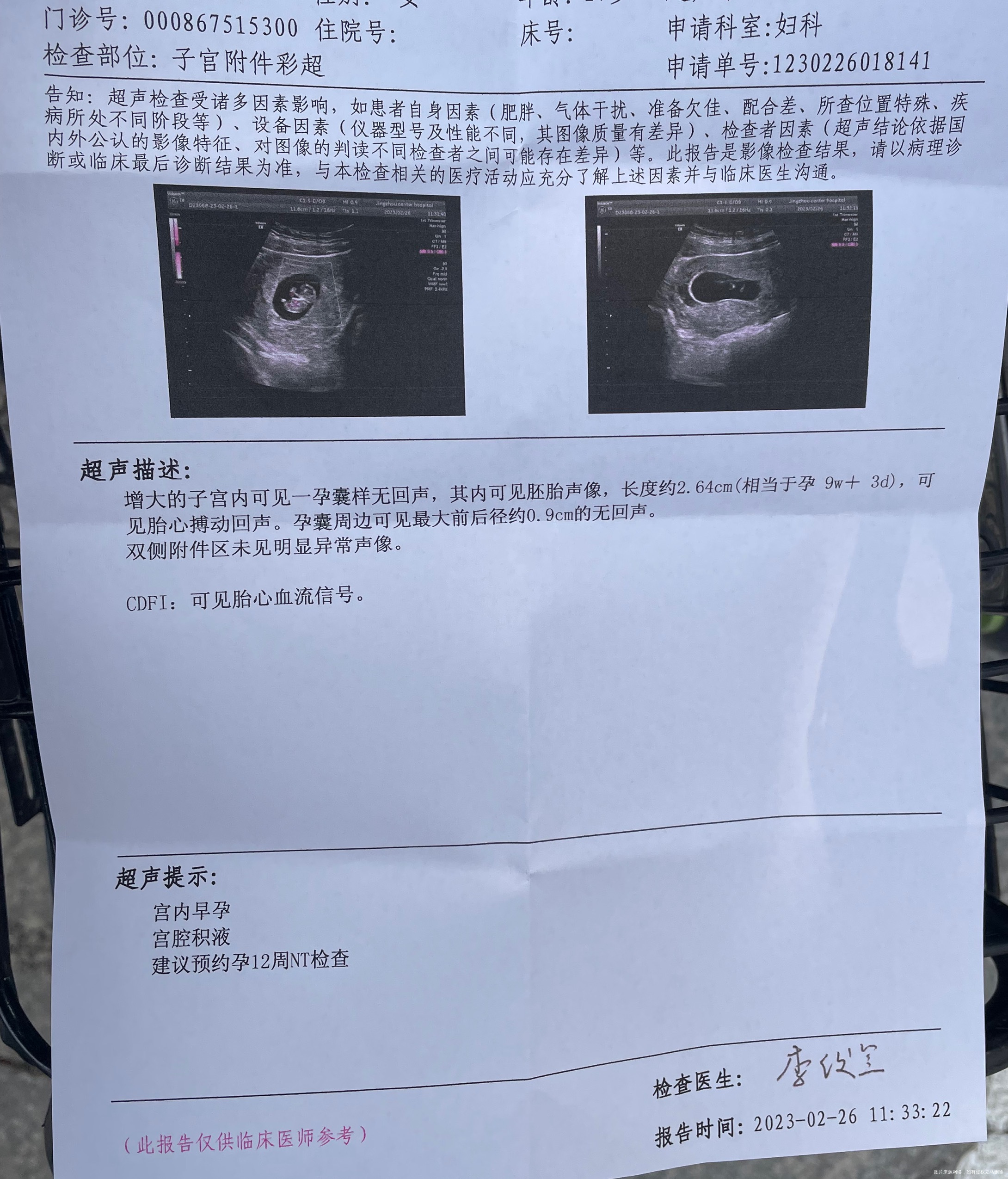 医生您好我这个B超单子是正常的不宫腔积液是咋