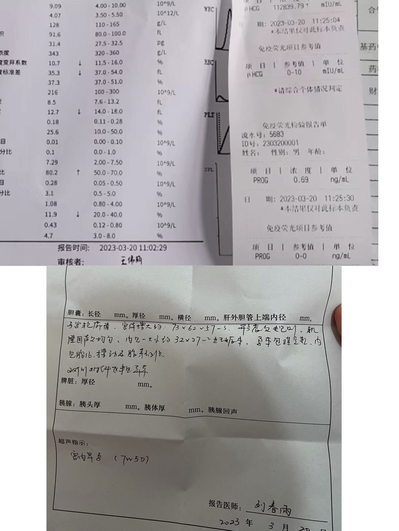 孕7周多五天前有褐色分泌物去检查孕酮2582