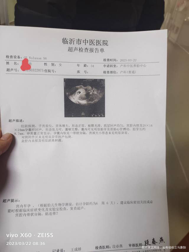 b超显示孕囊内有带状隔离带是什么意思对孩子有