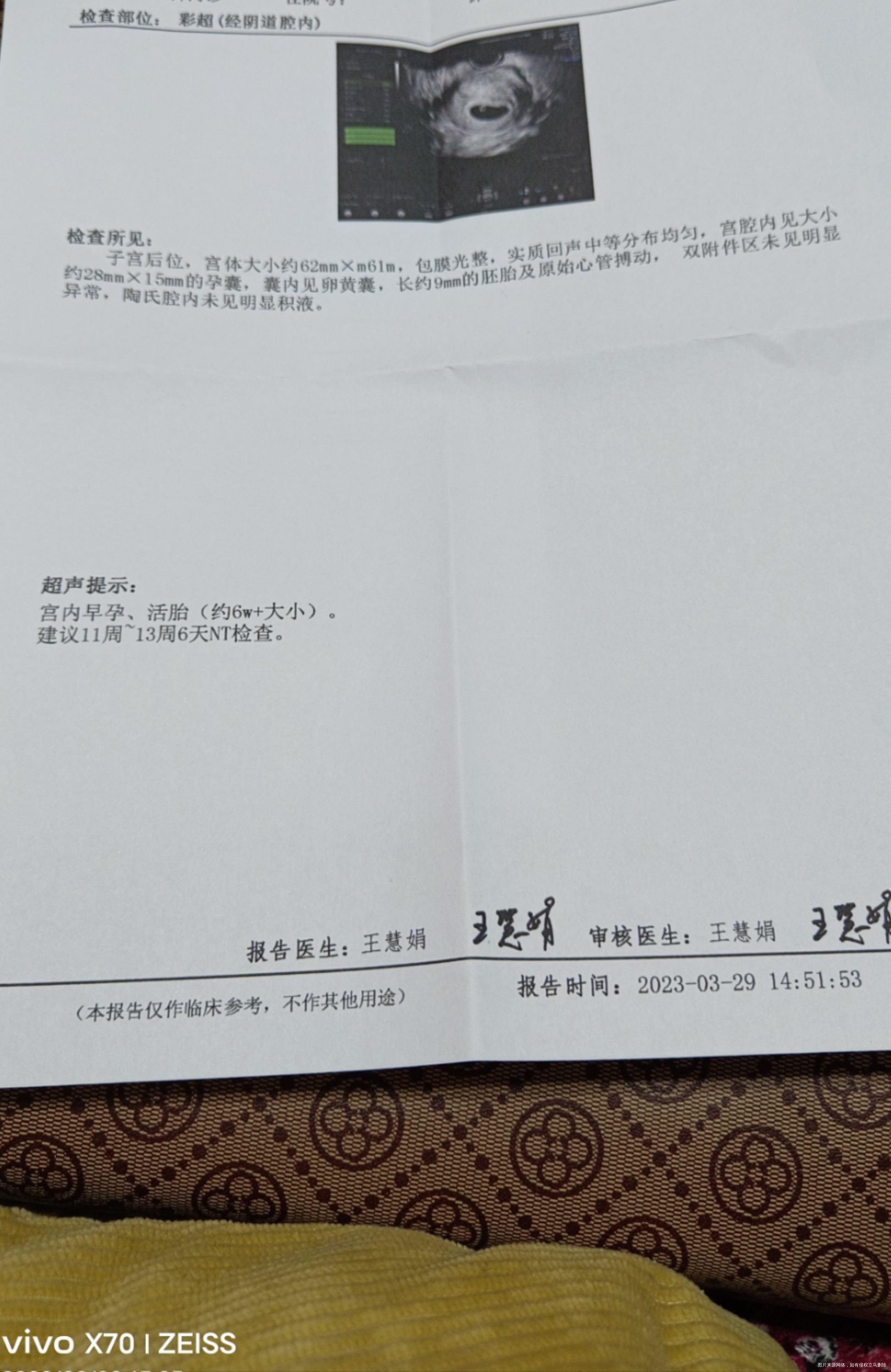 想咨询一下我的大姨妈一直不准时末次是1月20