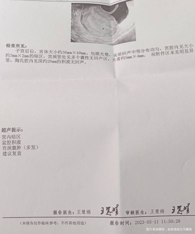 医生帮忙看看盆腔积液和宫颈肿多发有影响吗要怎