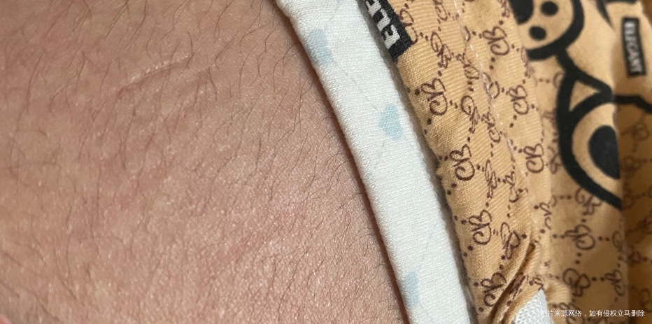 孕22周穿的孕妇裤跟孕妇内裤也不紧不知道怎么