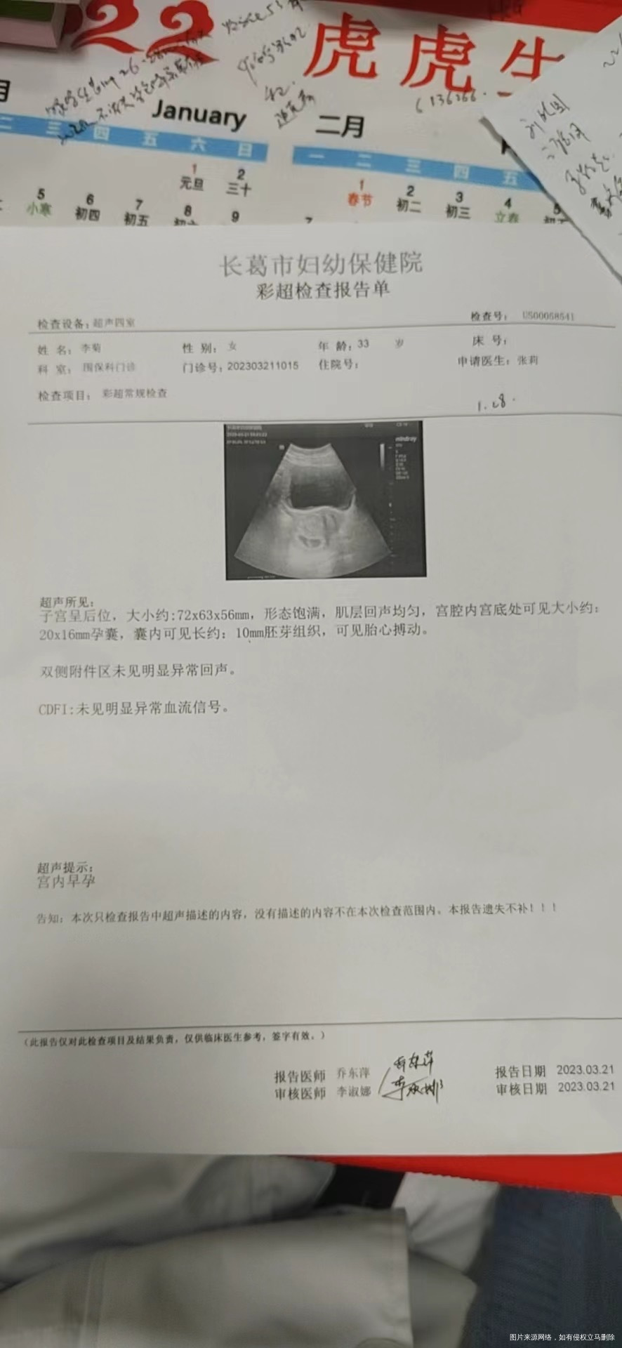 一个多月有褐色分泌物今天又去检查还是孕酮低让