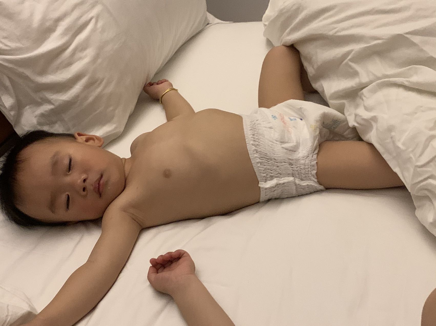 图1图2是我宝宝肚子上两根骨头好高图3⃣️是